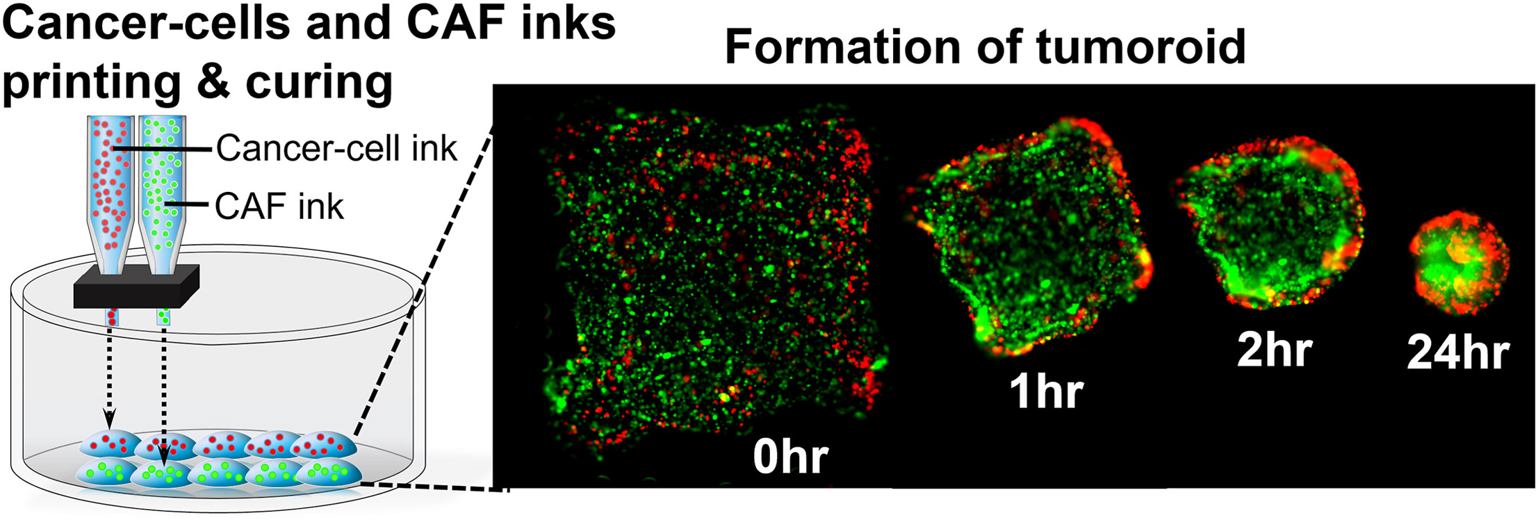 Inkjet Printing of Tumors